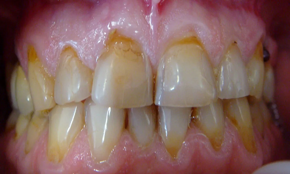 case 1 before