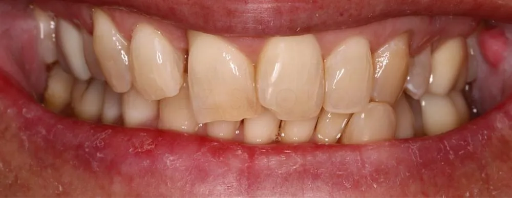 6 1