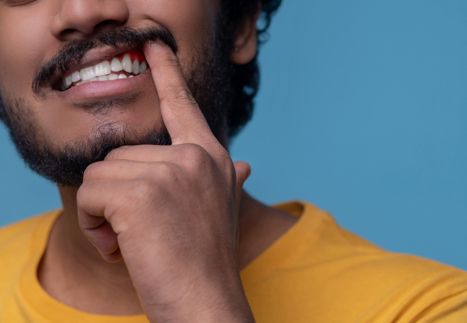 Gum Disease Prevention