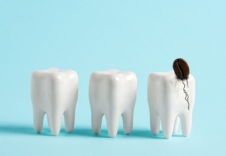 How Do Coffee and Tea Really Affect Your Teeth and What Can You Do About It